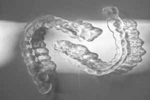 Clear aligners for a patient near Phoenix, AZ