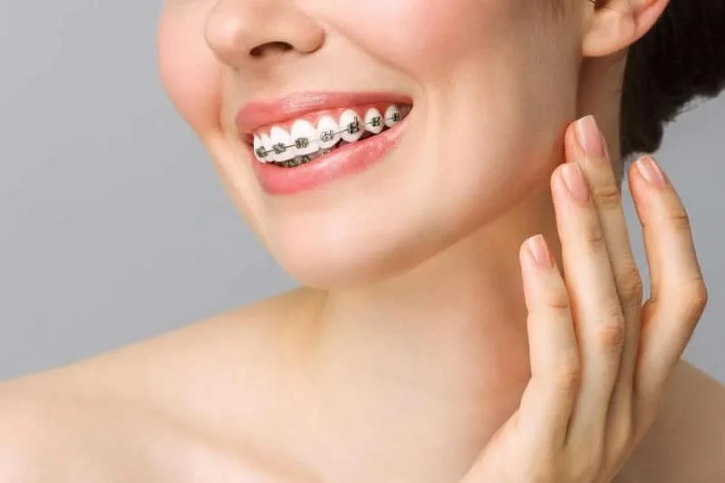 Clear Braces vs. Metal Braces